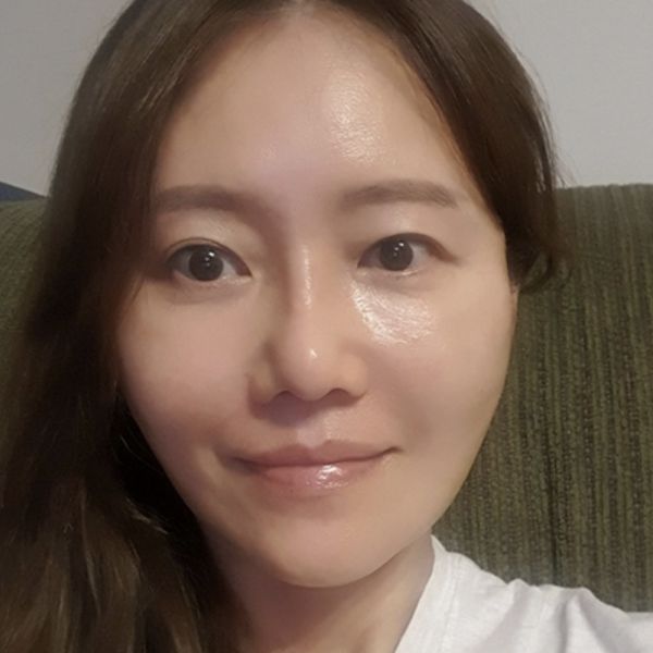 광대뼈수술 과정 3