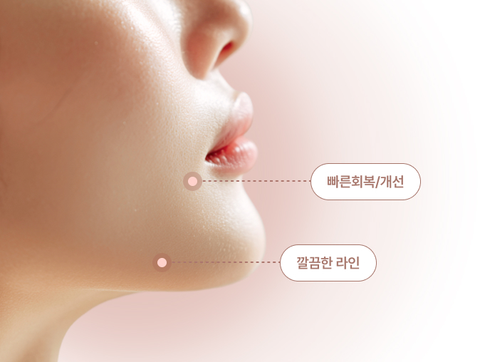 간단하고 확실한 시술